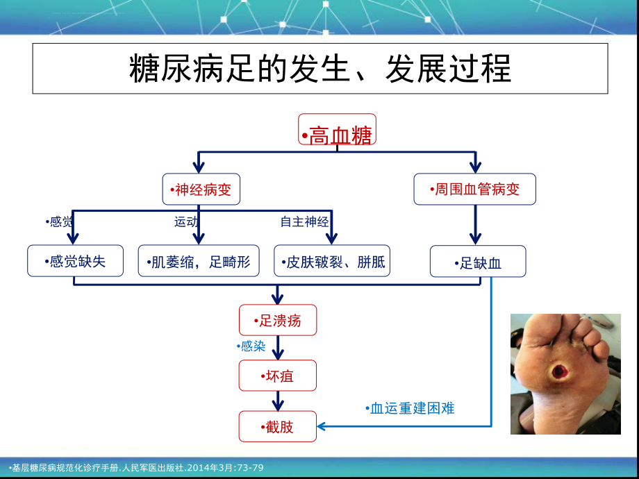 中国糖尿病足诊治指南(最新版)ppt课件.ppt_第2页