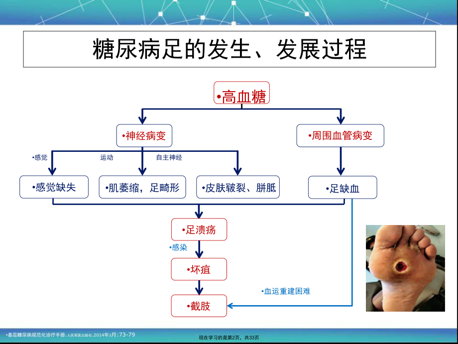 中国糖尿病足诊治指南最新版.ppt_第2页