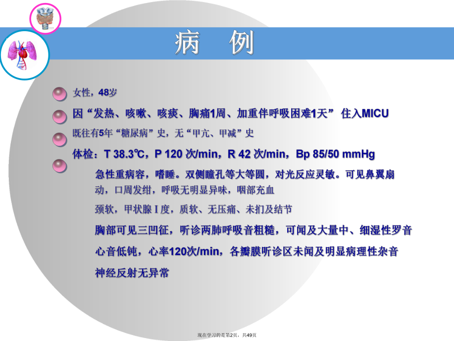 NTIS甲状腺功能正常病态综合征课件课件.ppt_第2页