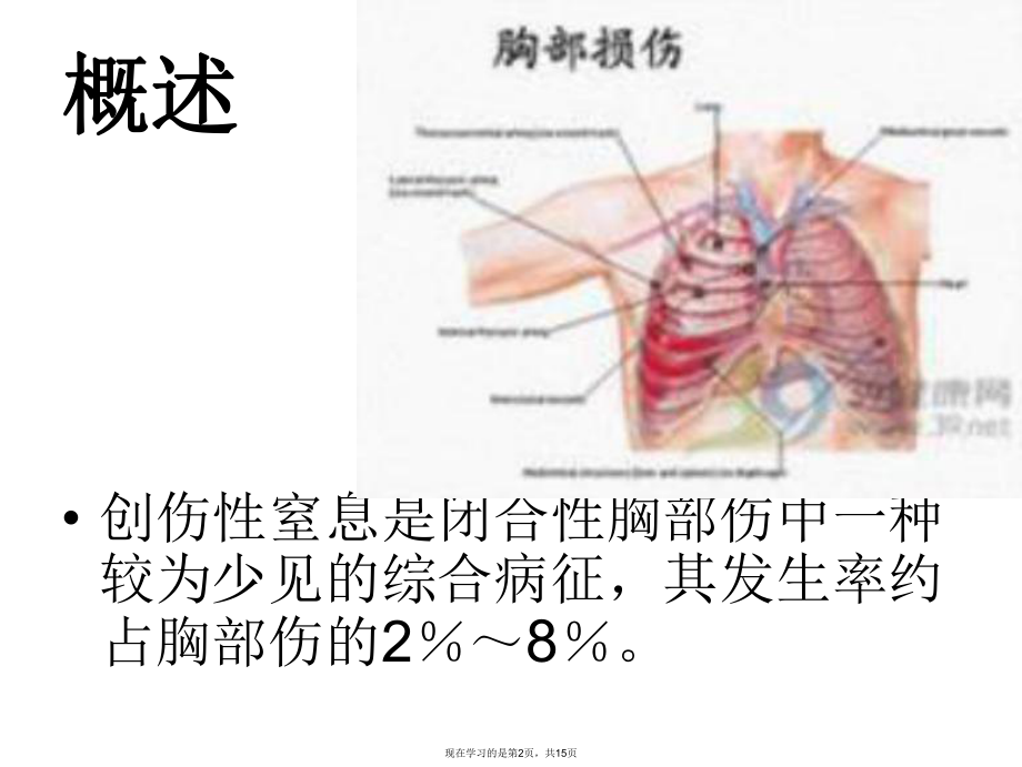 创伤性窒息.ppt_第2页