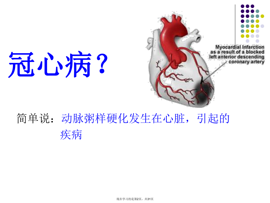 冠心病宣教.ppt_第2页