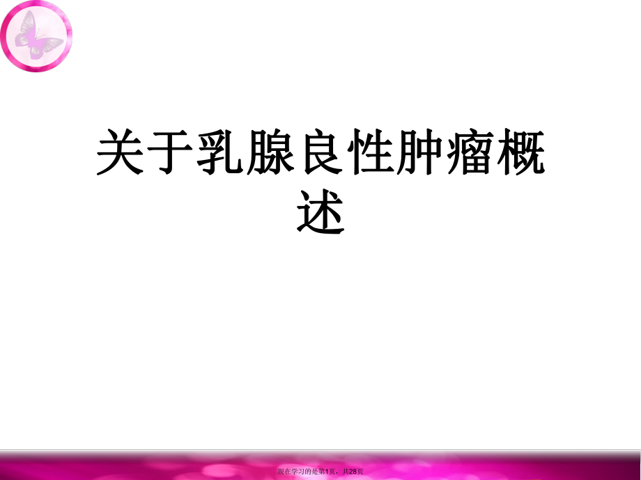 乳腺良性肿瘤概述.ppt_第1页