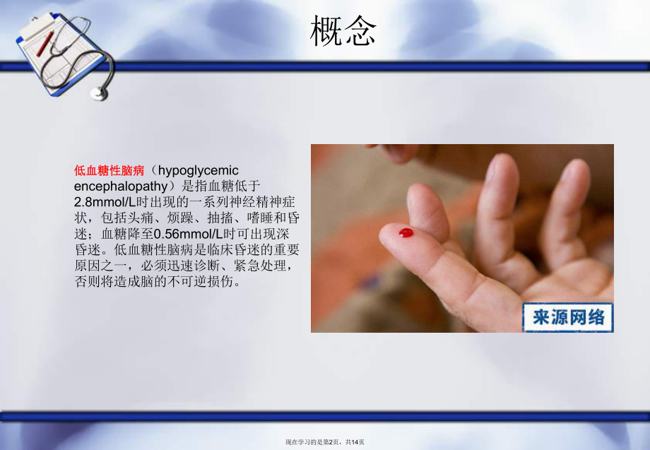 低血糖脑病护理查房.ppt_第2页