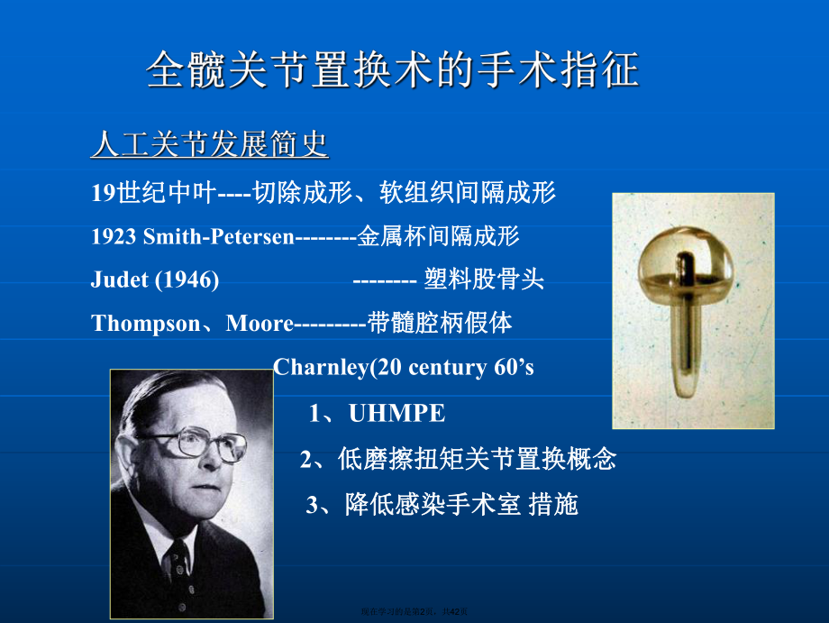 全髋关节置换术的手术指征.ppt_第2页