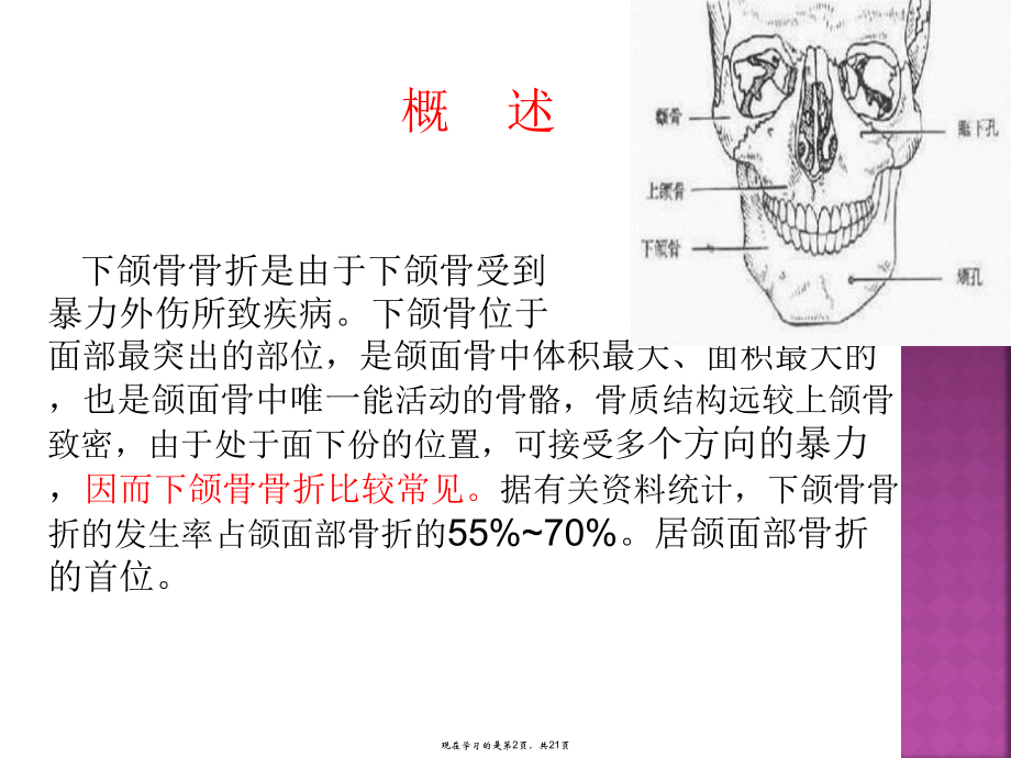 下颌骨骨折的护理查房课件.ppt_第2页