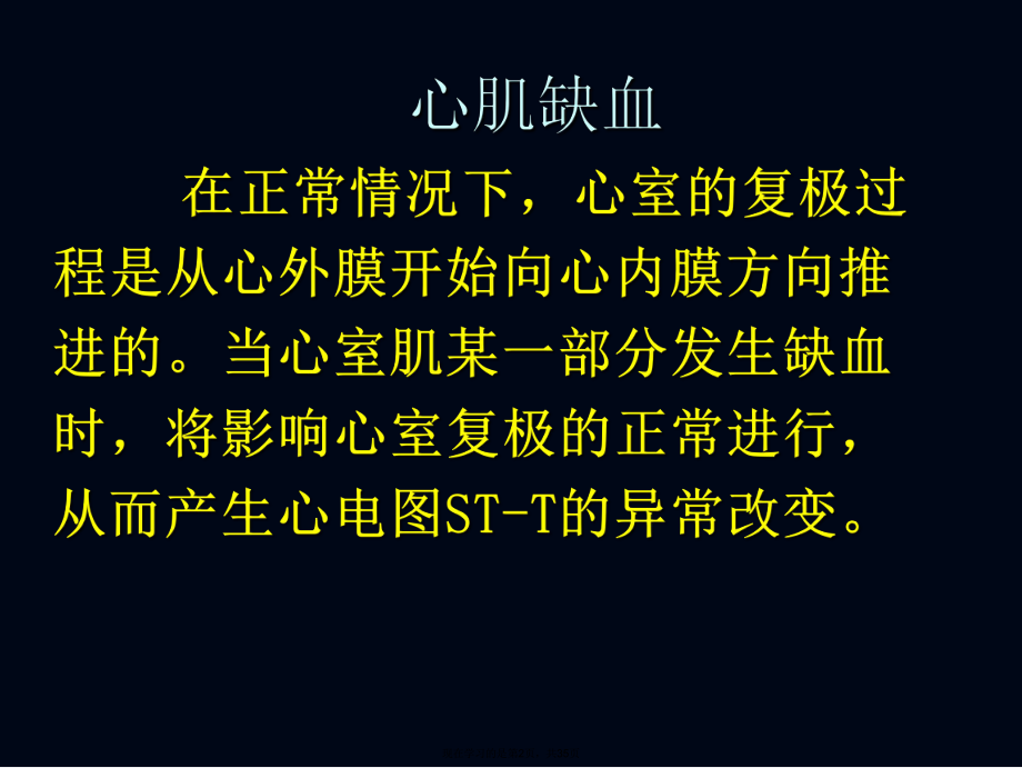 冠心病心电图.ppt_第2页