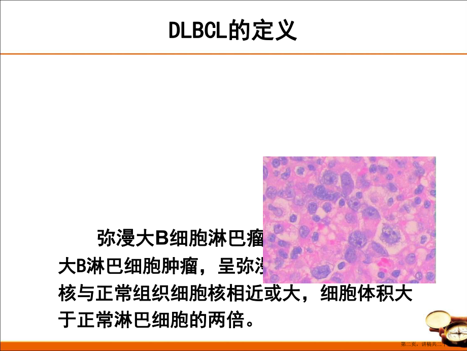 中国弥漫大细胞淋巴瘤诊治指南讲稿.ppt_第2页