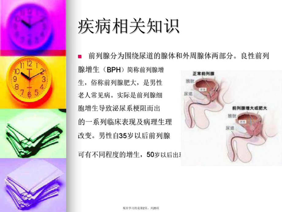 前列腺增生的术前术后护理.ppt_第2页