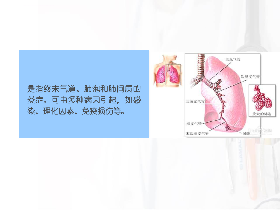 社区获得性肺炎的护理ppt课件.ppt_第2页