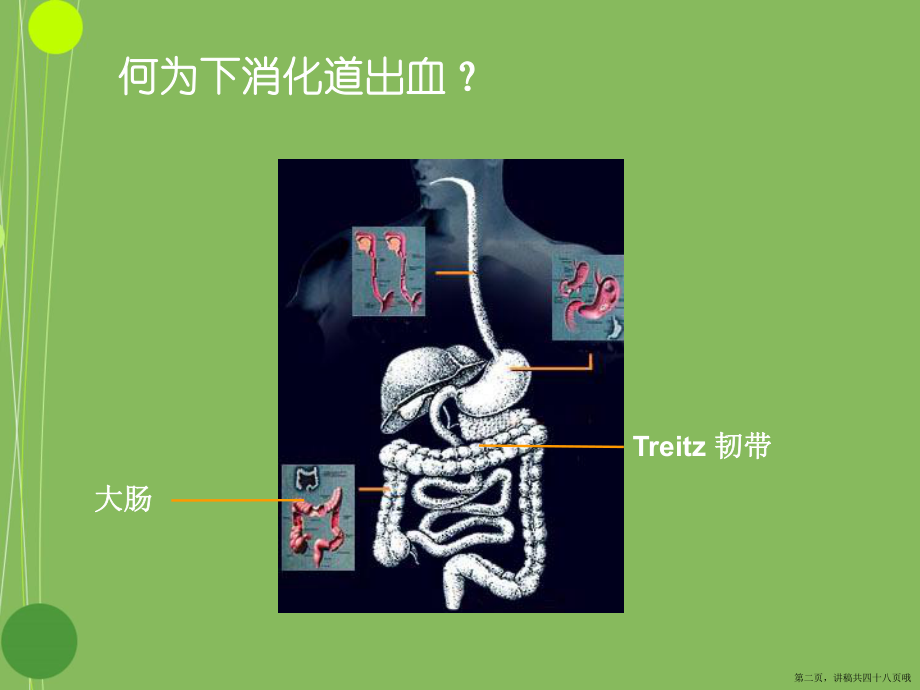 下消化道出血的诊治ppt讲稿.ppt_第2页