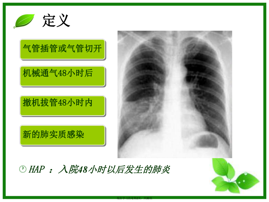 呼吸机相关性肺炎 .ppt_第2页