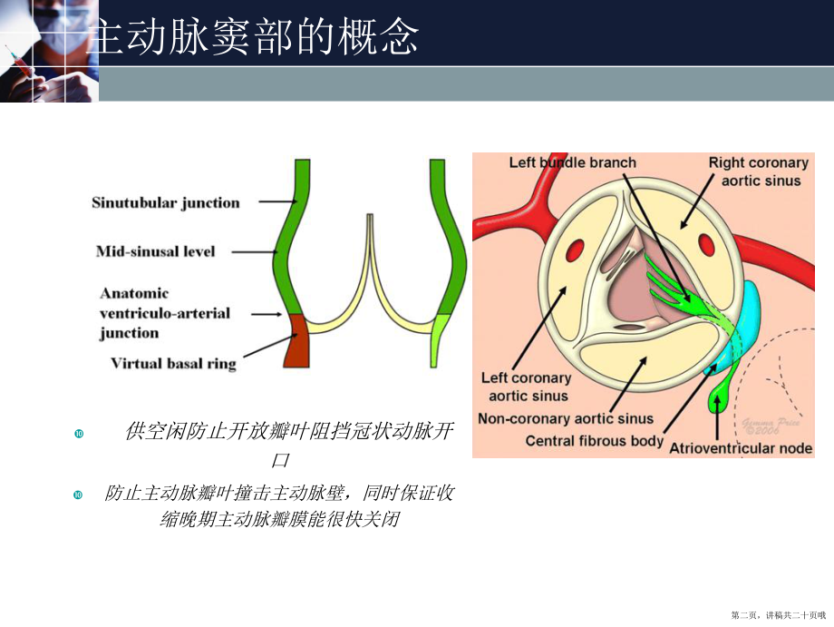 主动脉窦动脉瘤窦动脉瘤讲稿.ppt_第2页