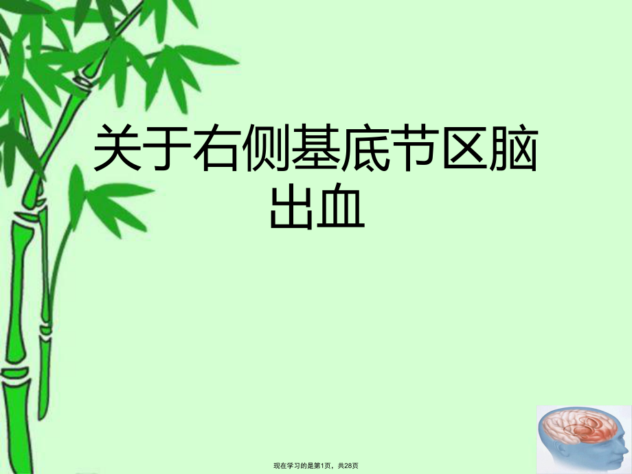 右侧基底节区脑出血.ppt_第1页