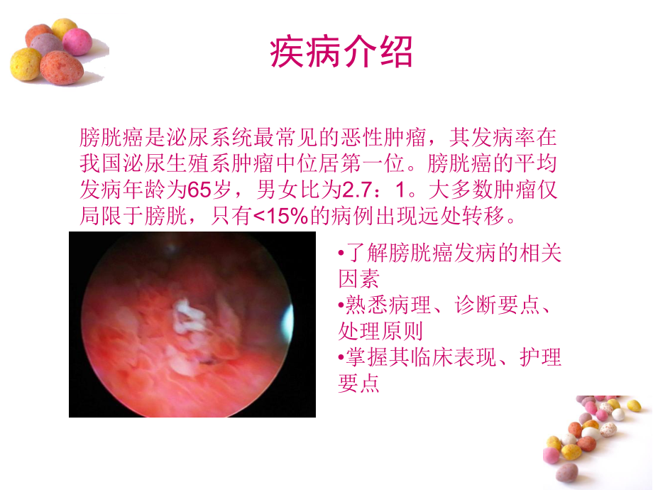 膀胱肿瘤病人的护理ppt课件.ppt_第2页