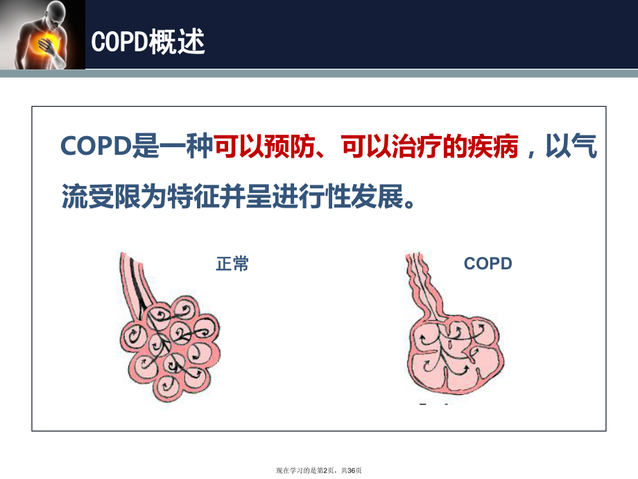 呼吸康复呼吸科患者教育.ppt_第2页