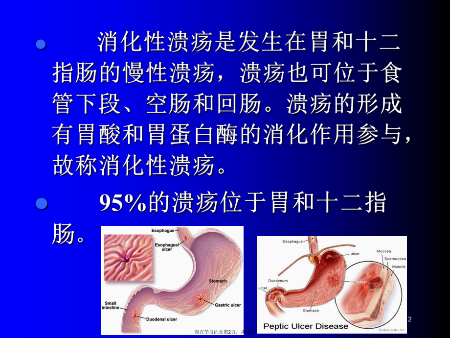 作用于消化系统的药物抗消化性溃疡药课件.ppt_第2页