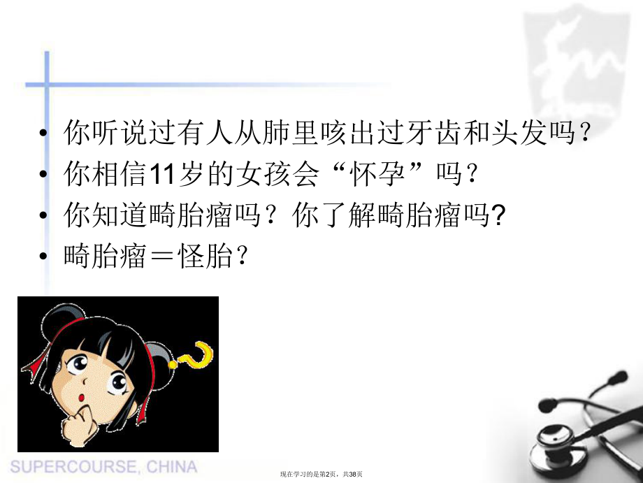 卵巢畸胎瘤 (2).ppt_第2页