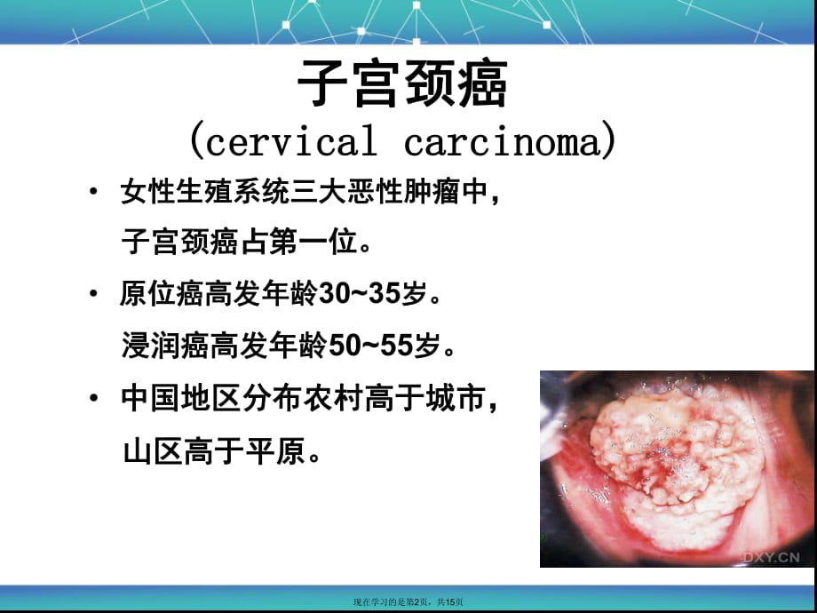 子宫颈癌的临床分期 (2).ppt_第2页