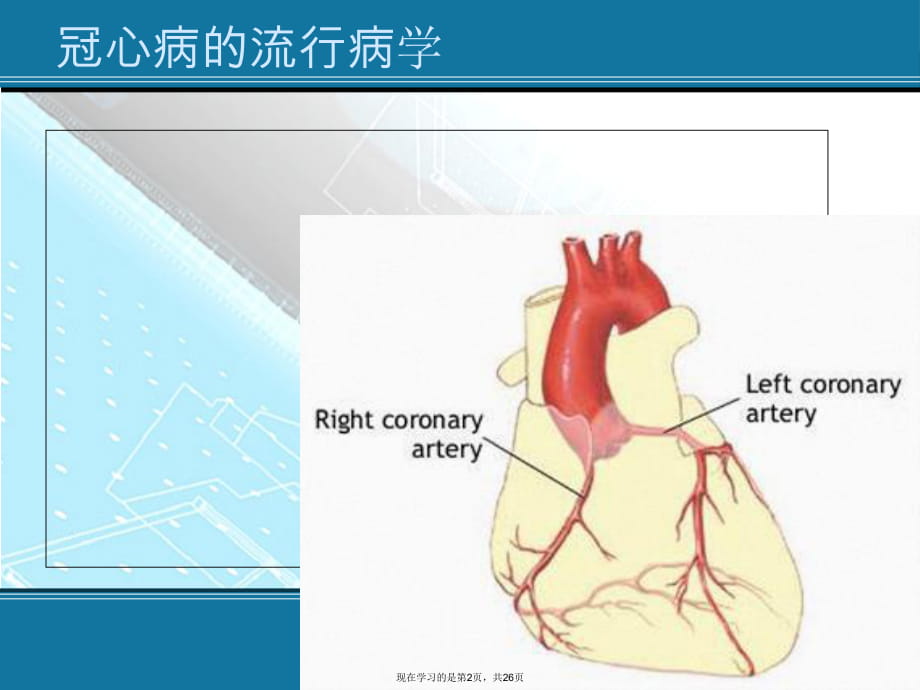 冠心病的康复治疗 (2)课件.ppt_第2页