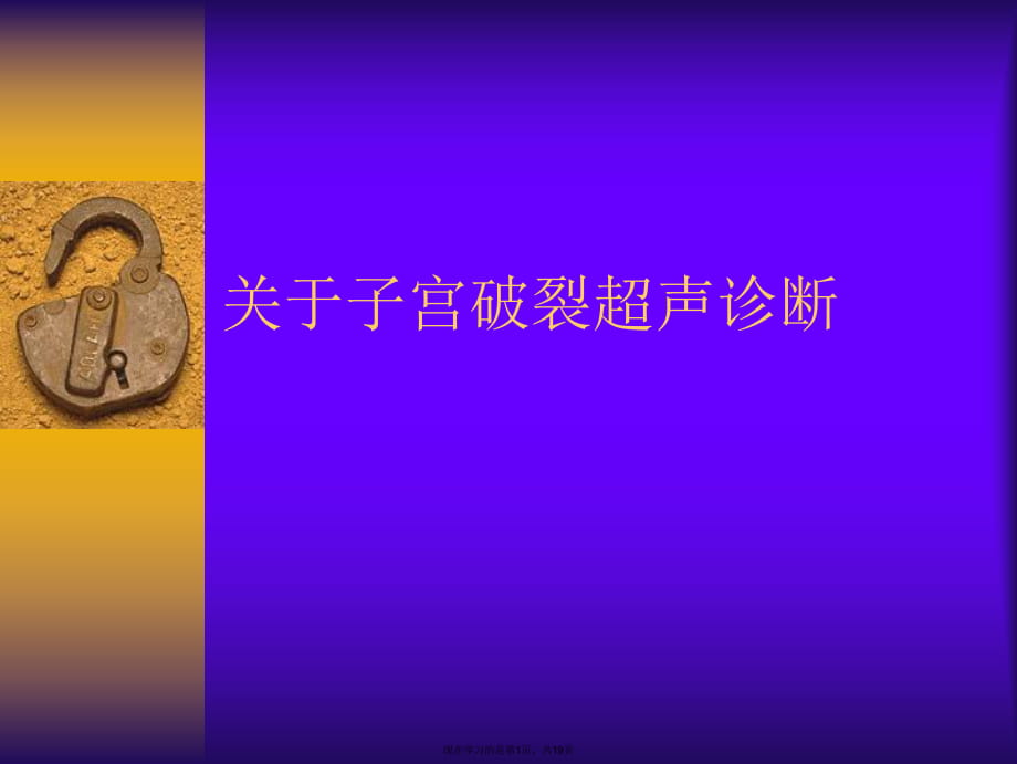 子宫破裂超声诊断.ppt_第1页