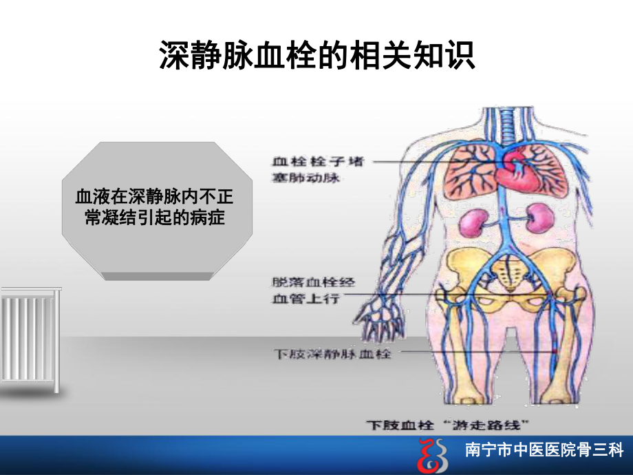 深静脉血栓的护理查房ppt课件.ppt_第2页