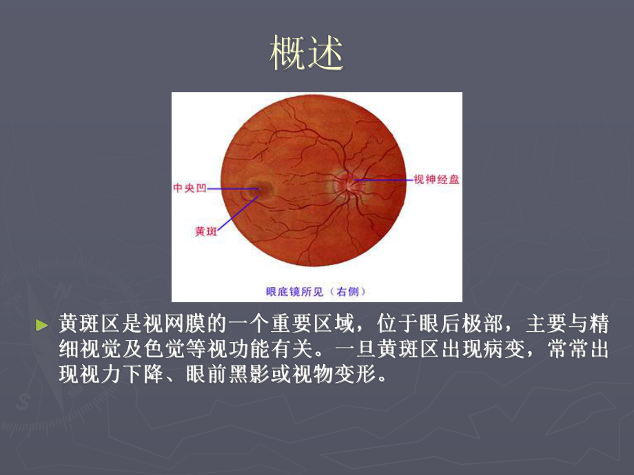 老年性黄斑变性ppt课件.ppt_第2页