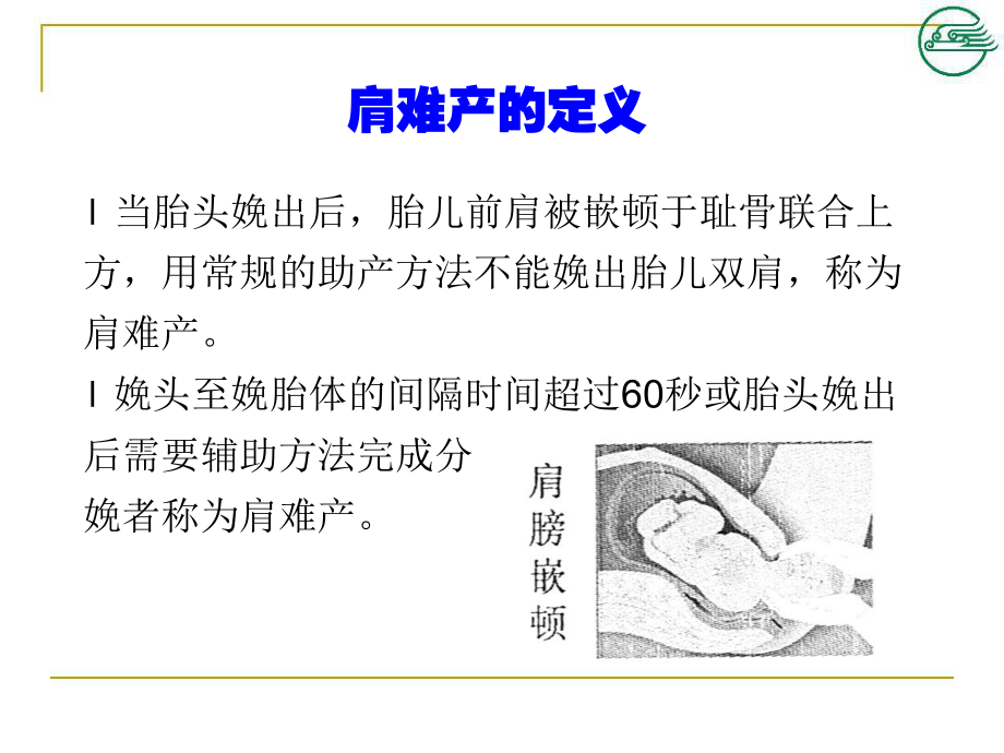 肩难产的定义ppt课件.ppt_第2页