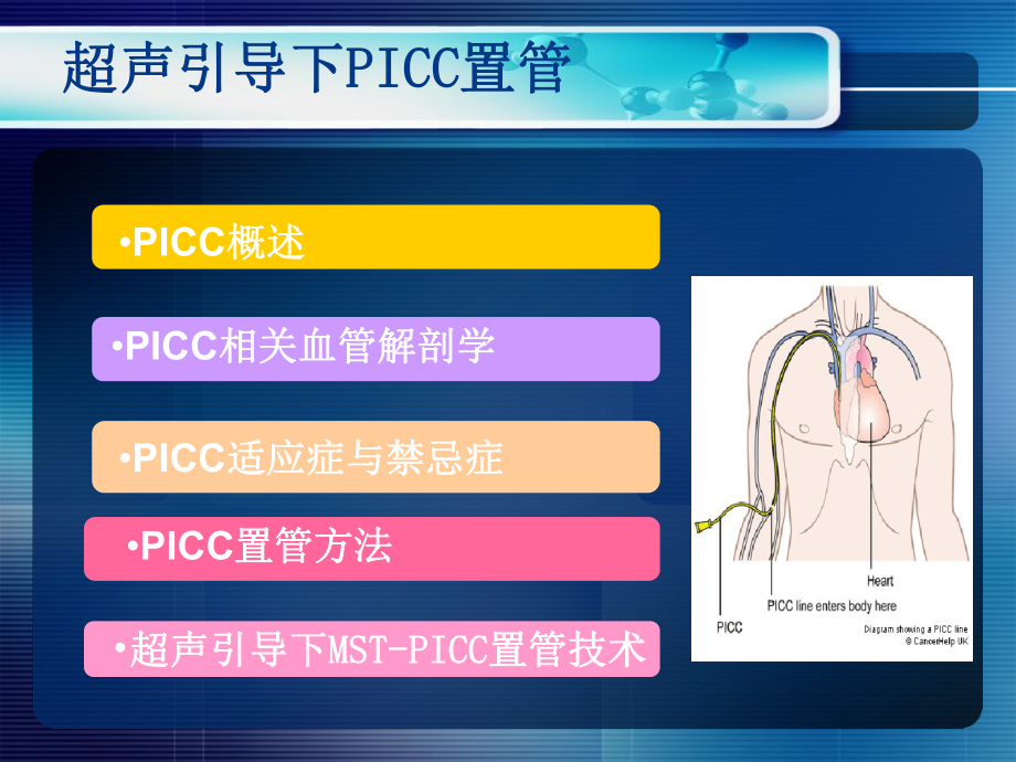 超声引导PICC置管ppt课件.ppt_第2页