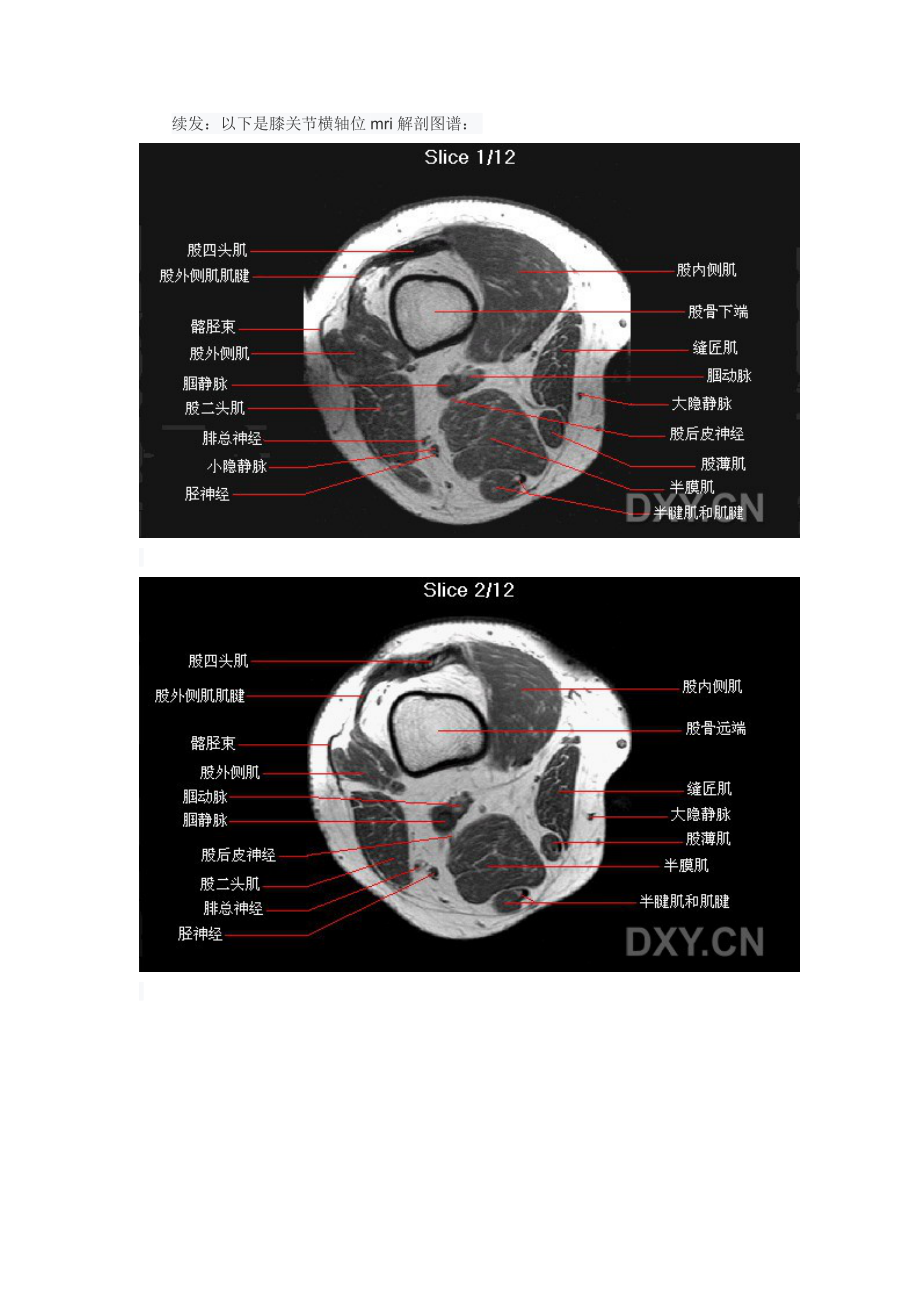 膝关节MR解剖.doc_第1页