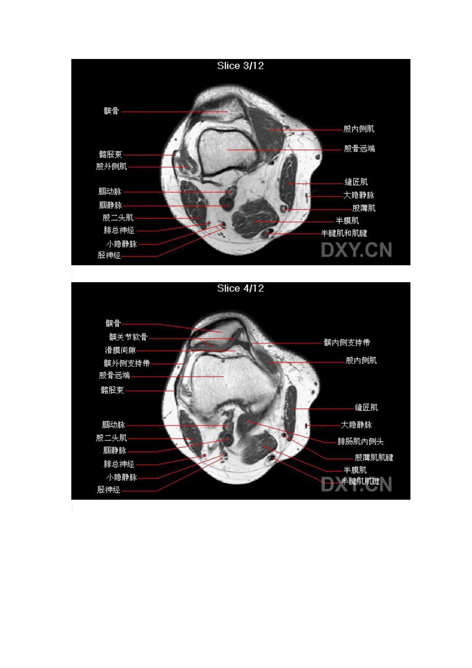 膝关节MR解剖.doc_第2页