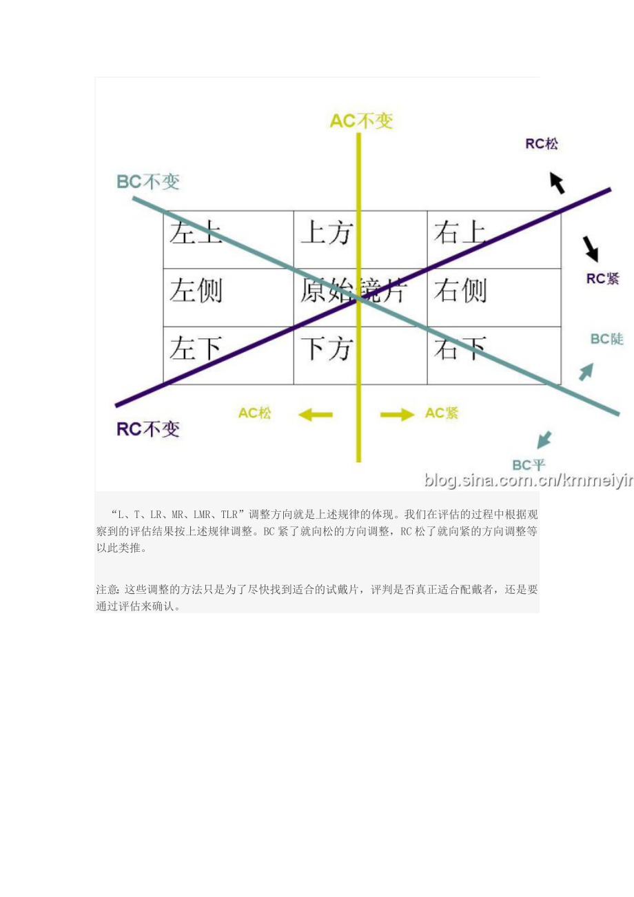 角膜塑形镜各弧区与镜片调整之间的关系.doc_第2页