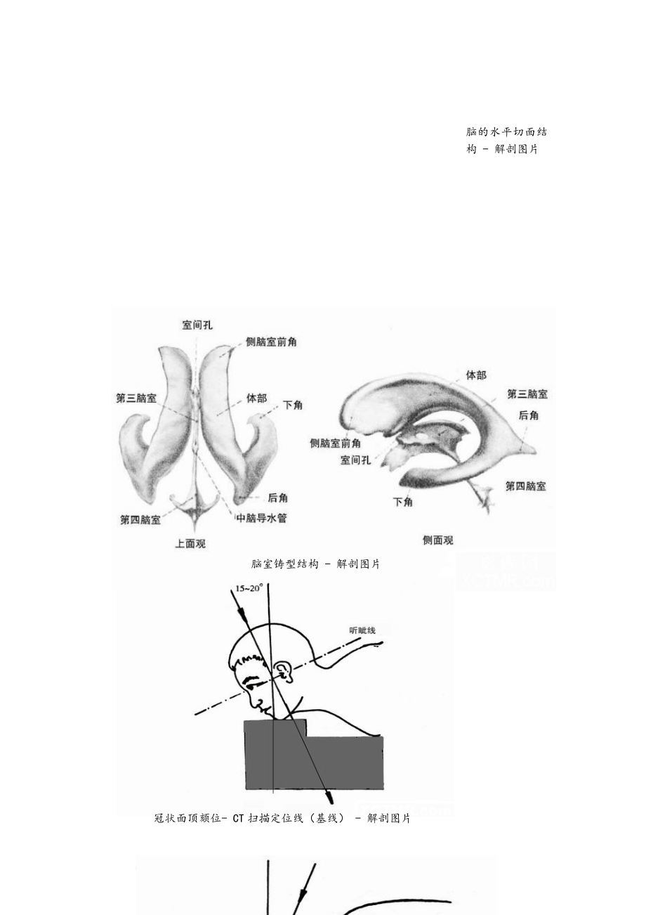 CT诊断学笔记图谱正版1文库有我盗版.docx_第2页