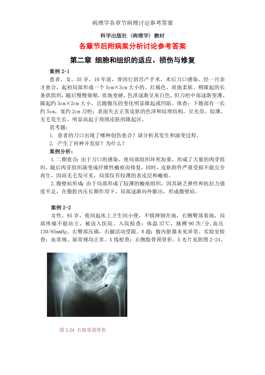 病理学各章节病理讨论参考答案.docx_第1页