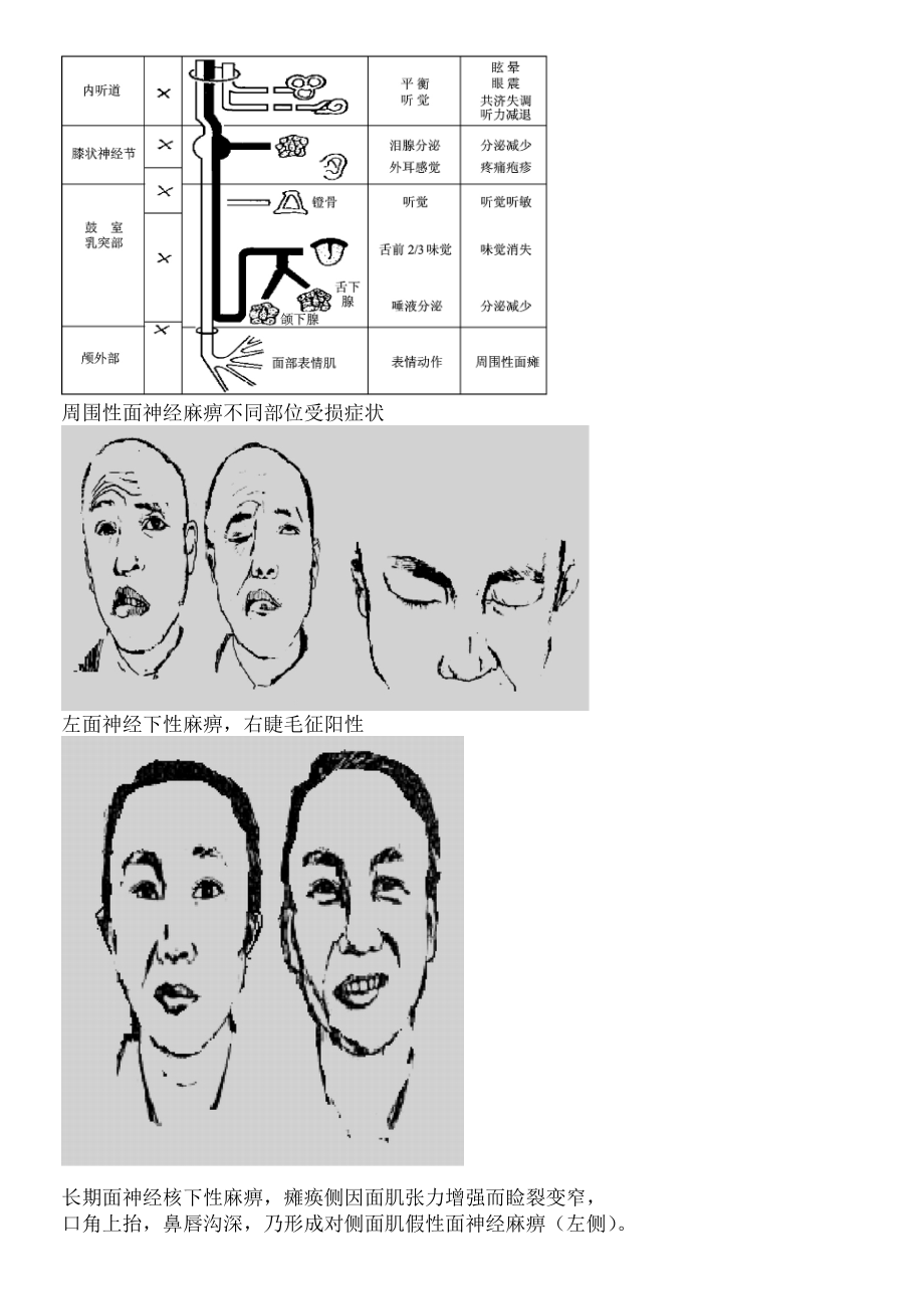 神经系统病例分析习题集.docx_第2页