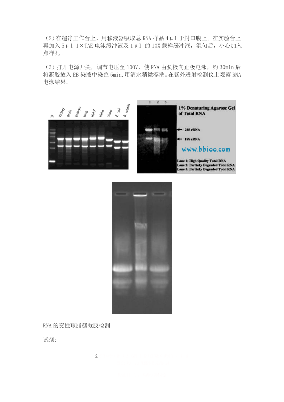 RNA的琼脂糖凝胶电泳实验原理和步骤.doc_第2页