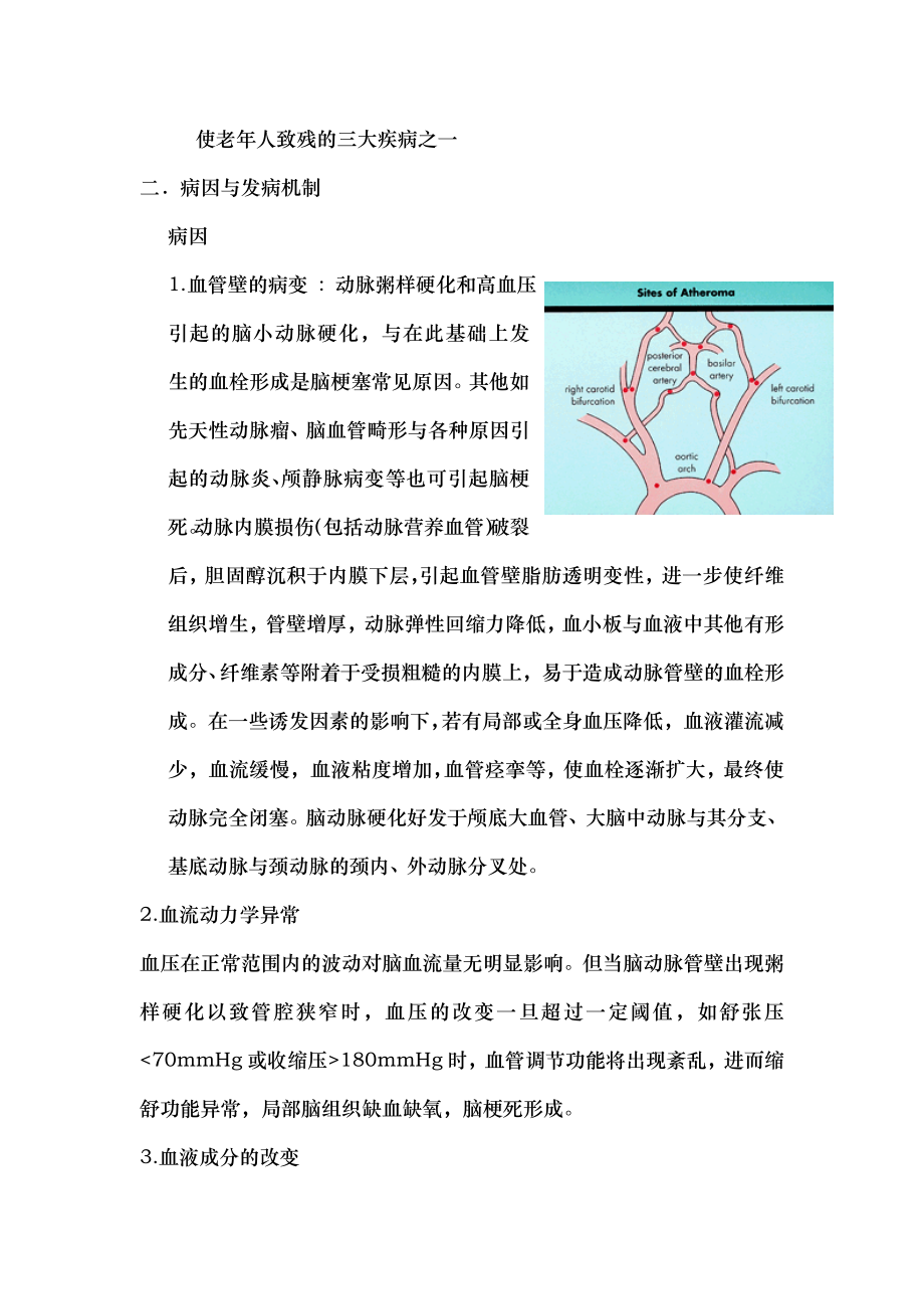 医学文档急性缺血性脑卒中.docx_第2页