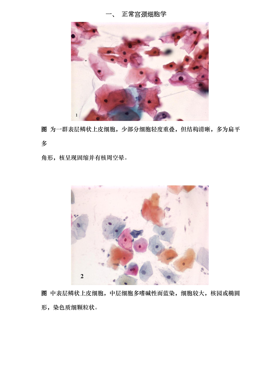 图谱宫颈细胞学.docx_第1页