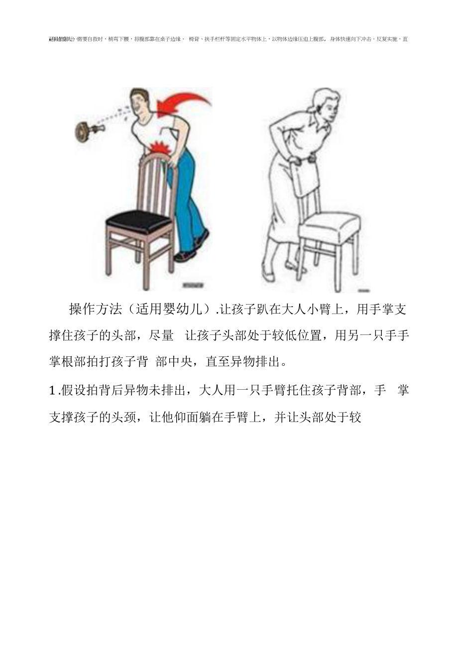 海姆立克急救法操作.docx_第2页