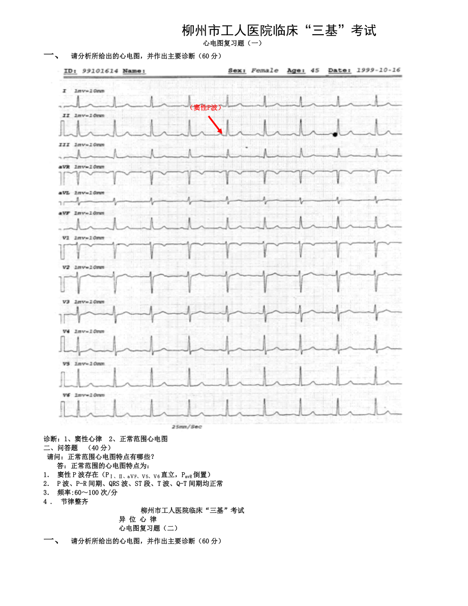 临床三基考试心电图复习题.doc_第1页