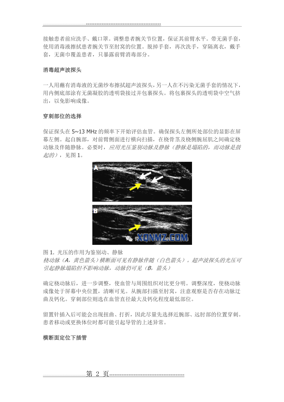 新英格兰医学杂志超声引导下桡动脉穿刺置管指南(4页).doc_第2页