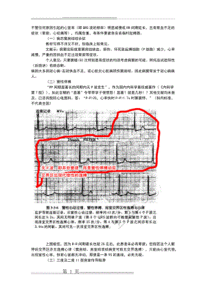 教你快速看懂心电图(18页).doc