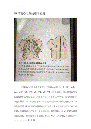 心电图18导联(4页).doc