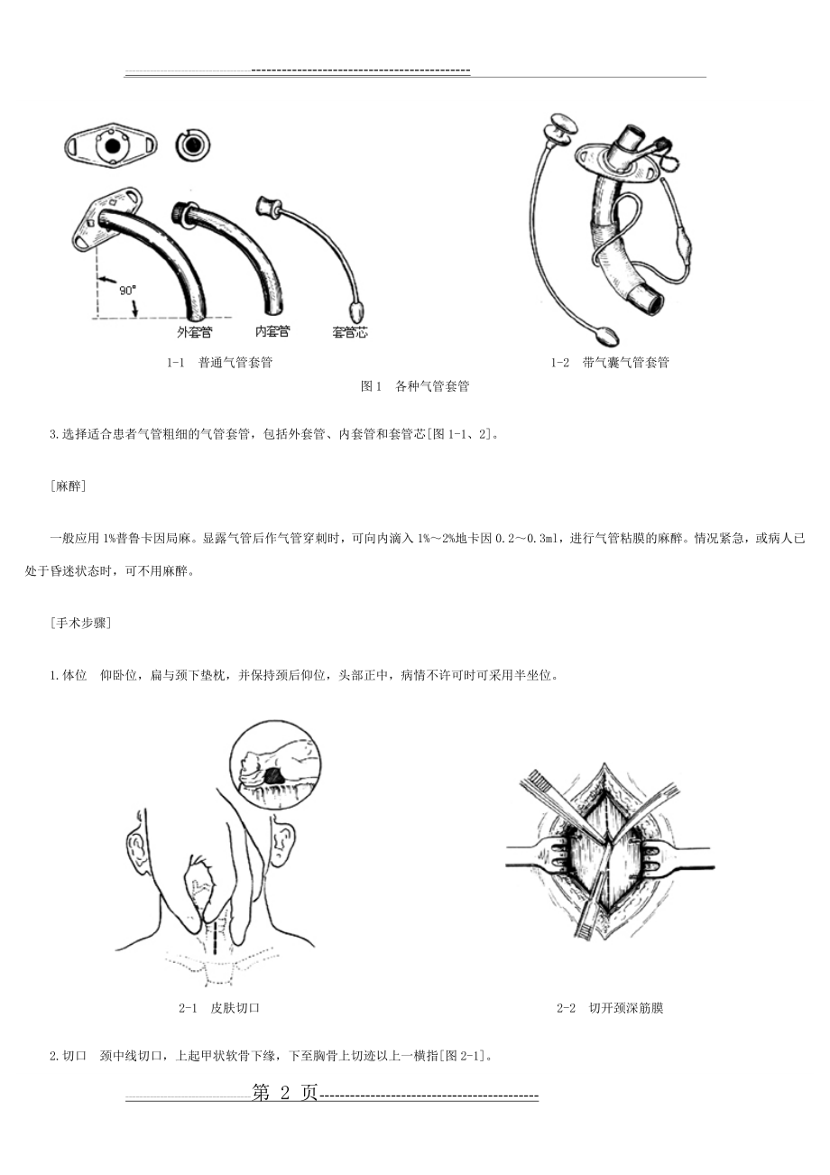 气管切开手术图解(6页).doc_第2页