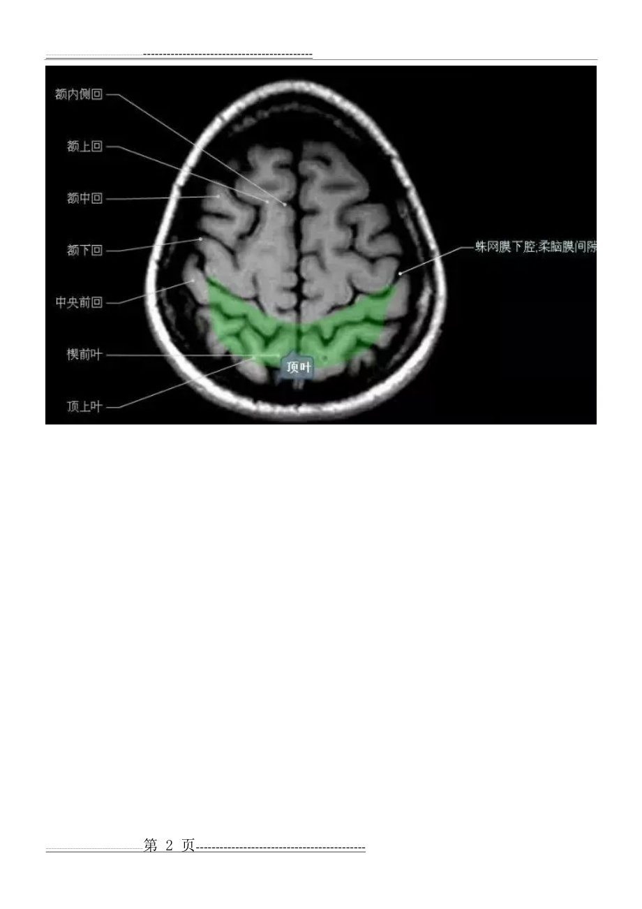 正常颅脑磁共振图示(21页).doc_第2页