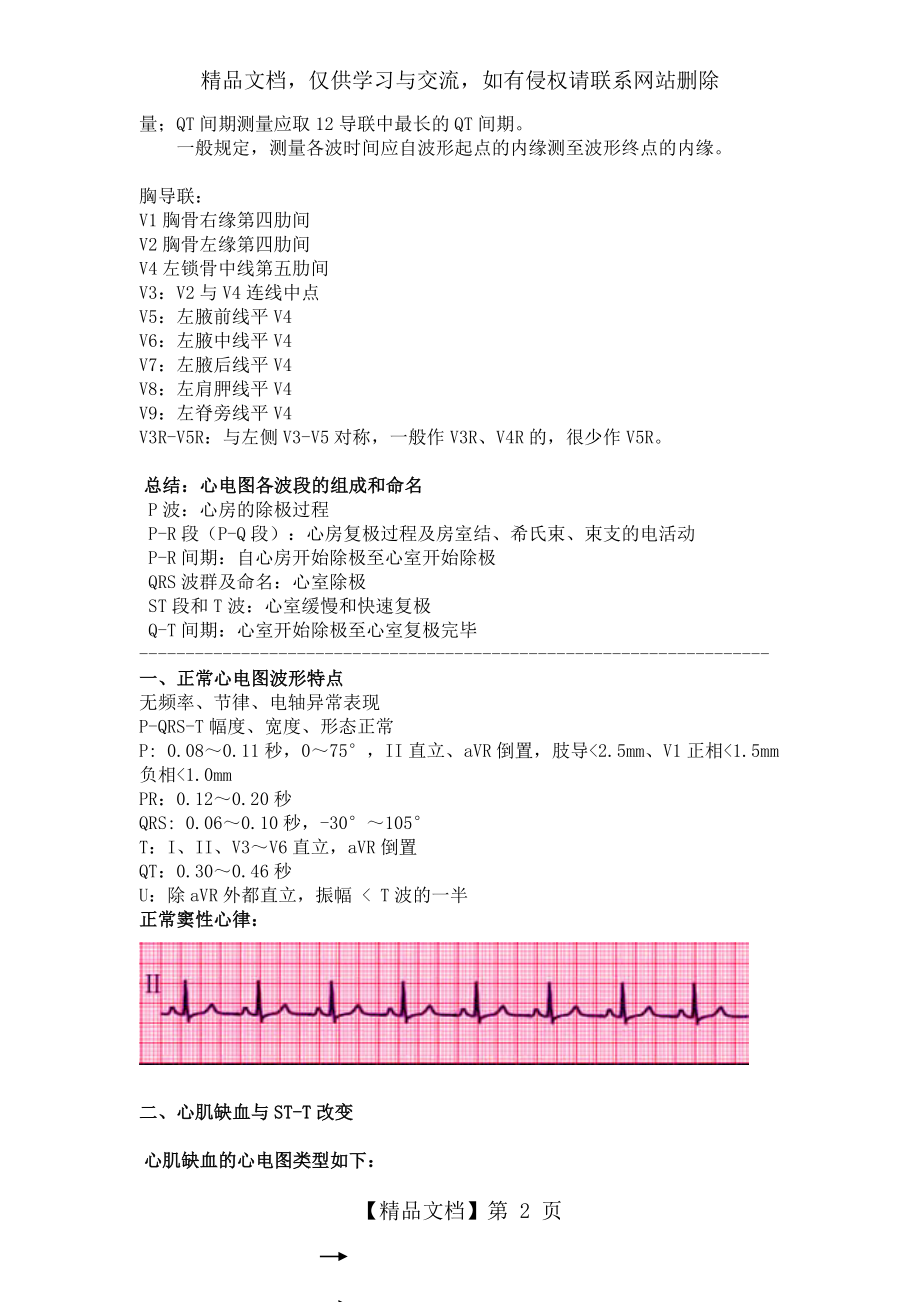 典型心电图详细讲解.doc_第2页