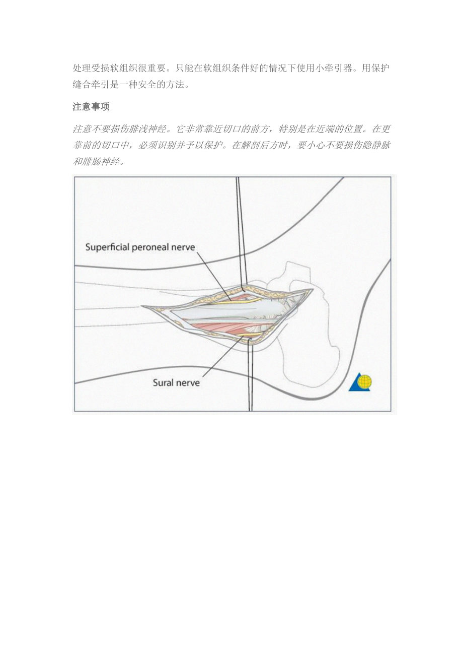 医学专题一外踝及腓骨下段手术入路.doc_第2页